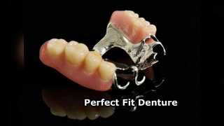 Metal Partial Denture Optimal Fit Easy Care
