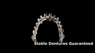 Titanium Dental Implant Bar for Dentures